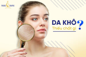 da khô thiếu chất gì