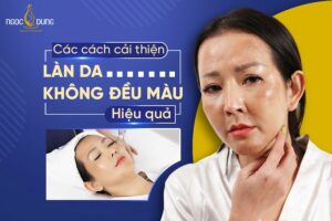 Da mặt không đều màu là gì? Tại sao da mặt không đều màu?