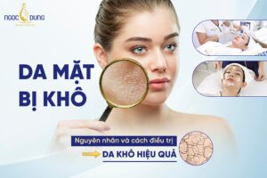 da mặt bị khô
