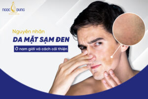 da mặt sạm đen ở nam giới
