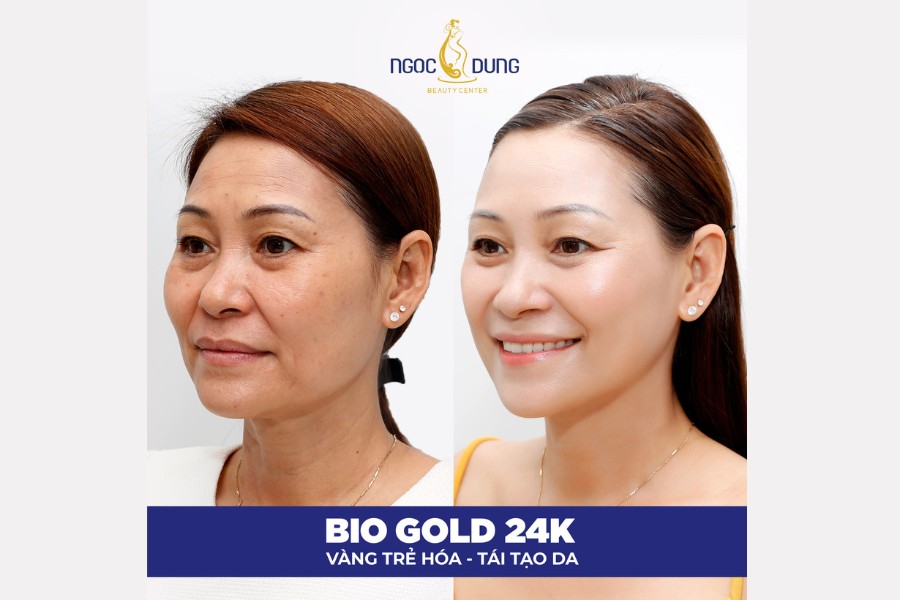 Công nghệ Bio Gold 24K là một trong những giải pháp vàng trẻ hóa và tái tạo da khô