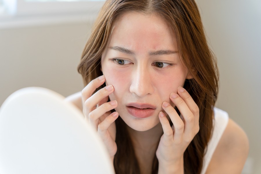 Việc lạm dụng mặt nạ nghệ có thể khiến làn da trở nên nhạy cảm, mỏng mang