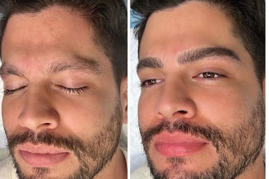 Điêu khắc chân mày nam tại Ngọc Dung mang đến kết quả khác biệt, an toàn, chất lượng