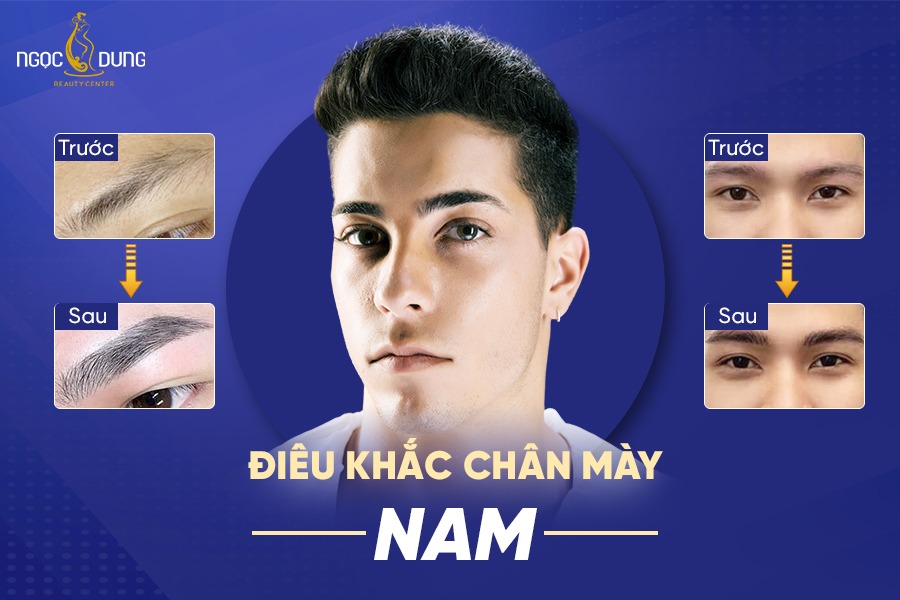 Khách hàng trước và sau khi điêu khắc chân mày nam tại Thẩm mỹ viện Ngọc Dung