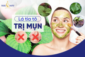 Lá tía tô trị mụn được không?