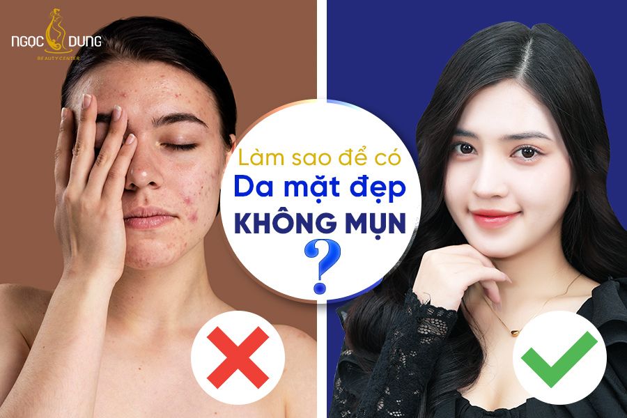Giải đáp từ chuyên gia: Làm sao để có da mặt đẹp không mụn
