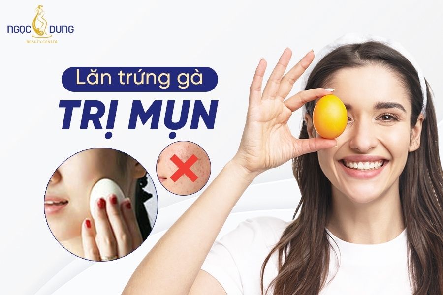 Lăn mụn bằng trứng gà liệu có thần kỳ như lời đồn? Tìm hiểu ngay