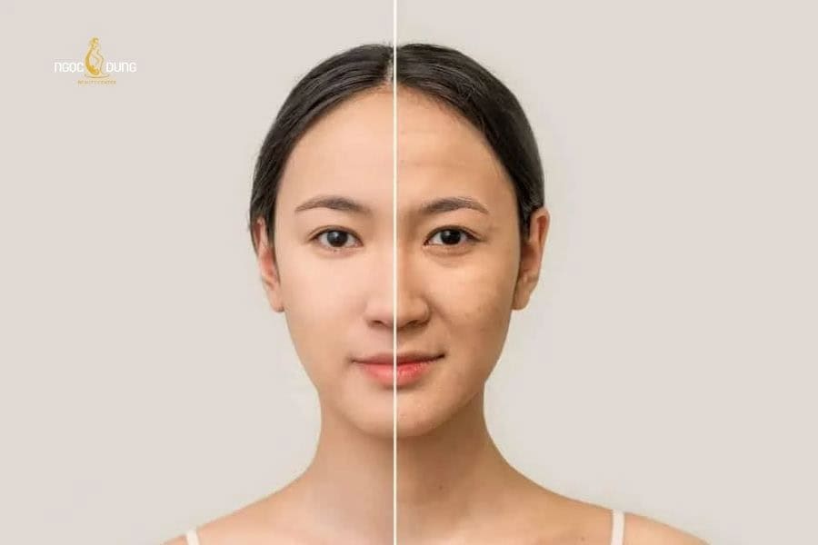 Thực hiện liệu pháp trẻ hóa da từ sớm giúp làm chậm tốc độ lão hóa da
