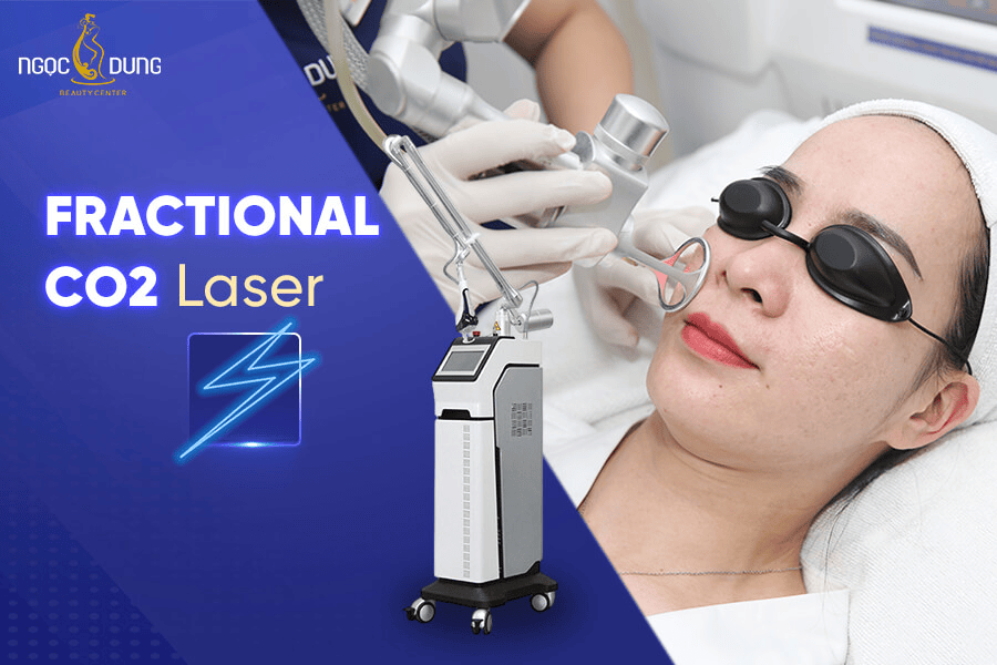 Laser Fractional CO2 trị sẹo rỗ có hết không? Bao lâu da đẹp? 2 Laser Fractional CO2 trị sẹo rỗ có hiệu quả không?
