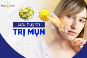 Dùng lưu huỳnh trị mụn có tốt không?