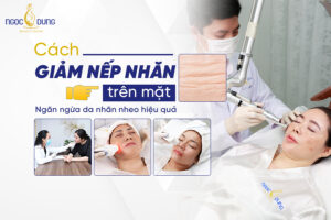 nếp nhăn