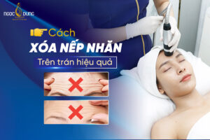 nep nhan tren tran