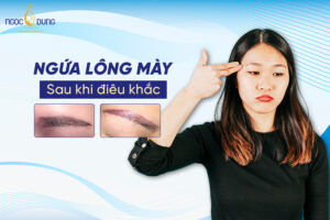 Bị nổi mụn nước, ngứa lông mày sau khi điêu khắc phải làm sao?