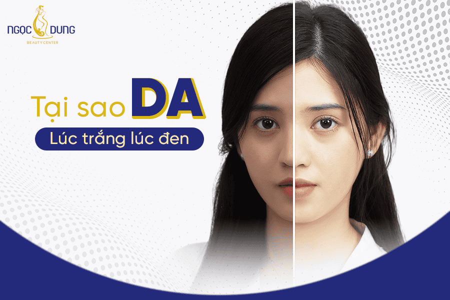 Nguyên nhân và cách khác phục tình trạng da lúc trắng lúc đen