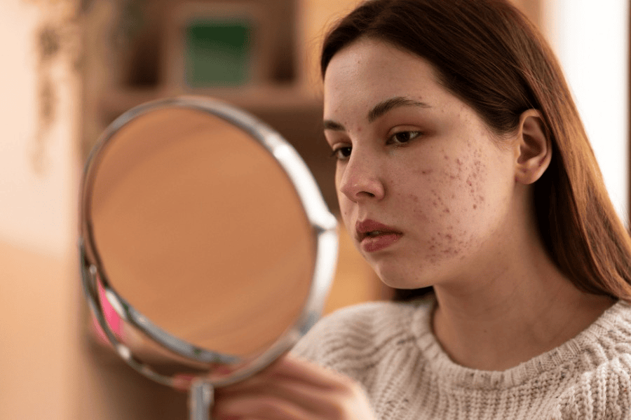 Những biến chứng nguy hiểm khi lạm dụng Corticoid trong thời gian dài