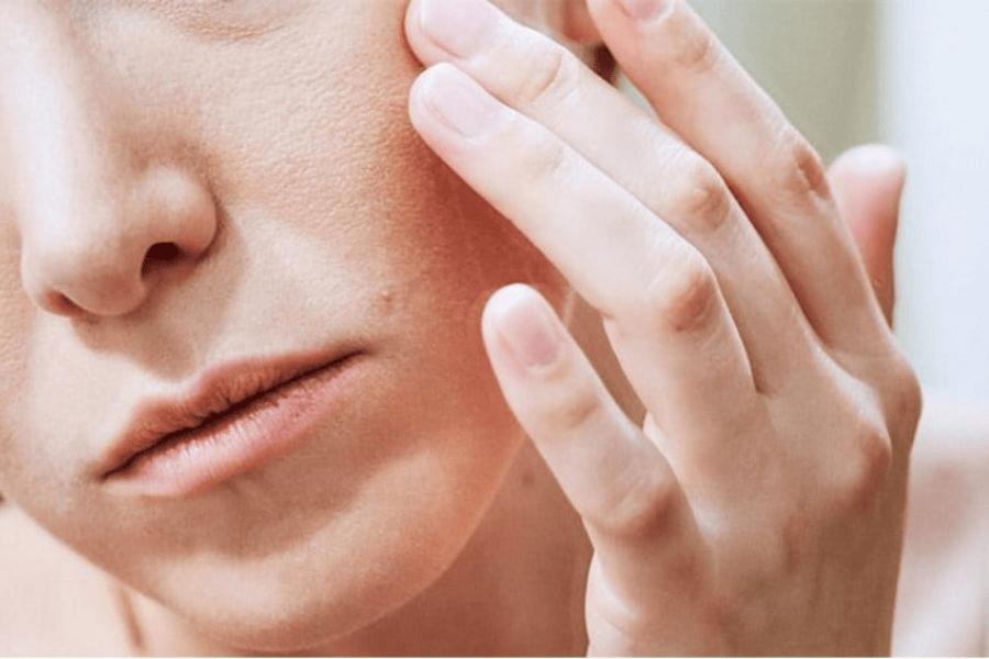 Những dấu hiệu nhận biết da sần vỏ cam