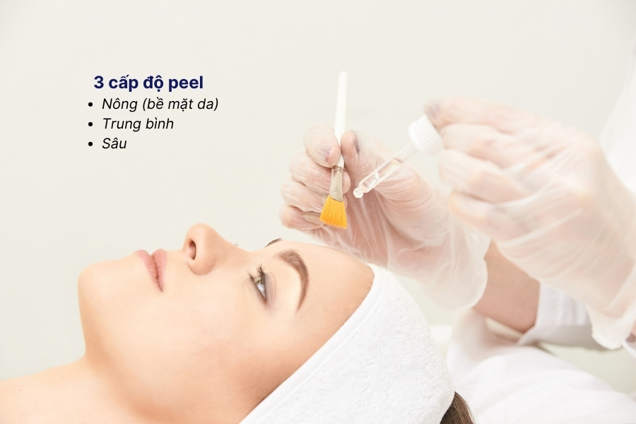 Peel da trị mụn có 3 cấp độ cơ bản phù hợp với từng tình trạng da