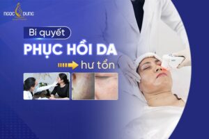 Phục hồi da là gì? Tổng hợp các cách phục hồi da hư tổn nặng