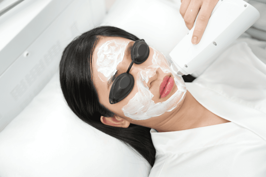 Quy trình peel da an toàn và chuẩn y khoa tại TMV Ngọc Dung