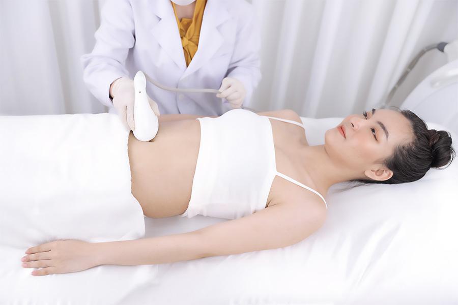 Quy trình trị rạn da chuẩn y khoa tại TMV Ngọc Dung