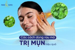 Rau má trị mụn được không? Tổng hợp các cách dùng rau má trị mụn có thể bạn chưa biết 