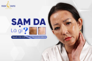 sạm da