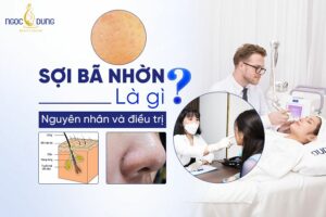 Sợi bã nhờn
