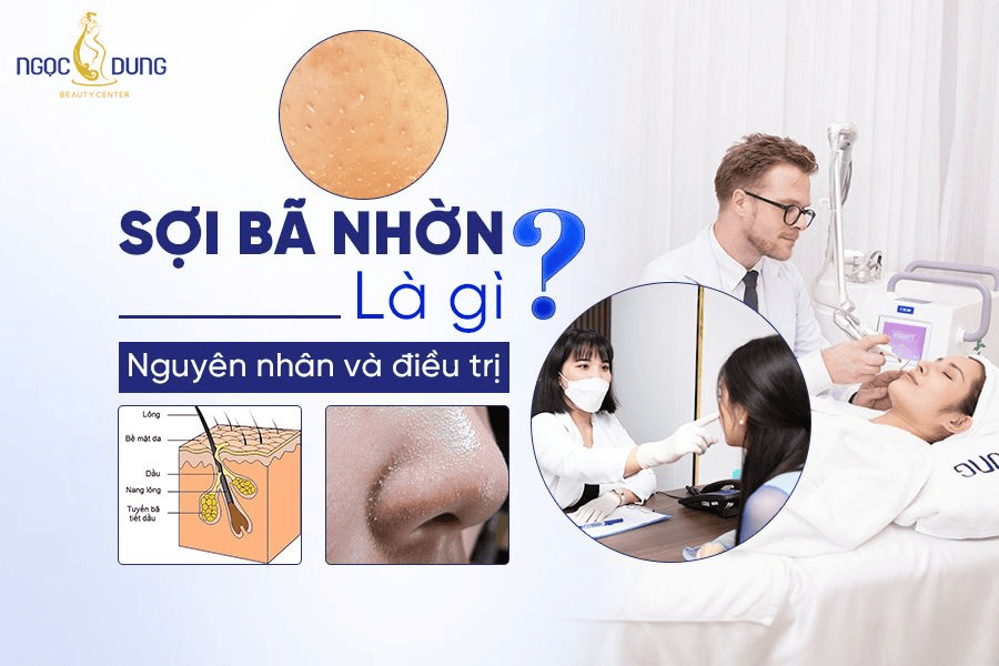 Sợi bã nhờn là gì? Có ảnh hưởng tới thẩm mỹ không?