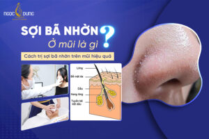 Sợi bã nhờn mũi ở mũi