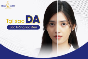 tại sao da lúc trắng lúc đen