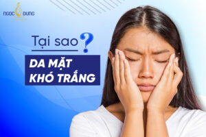 Tại sao da mặt khó trắng? 7 Nguyên nhân và cách cải thiện