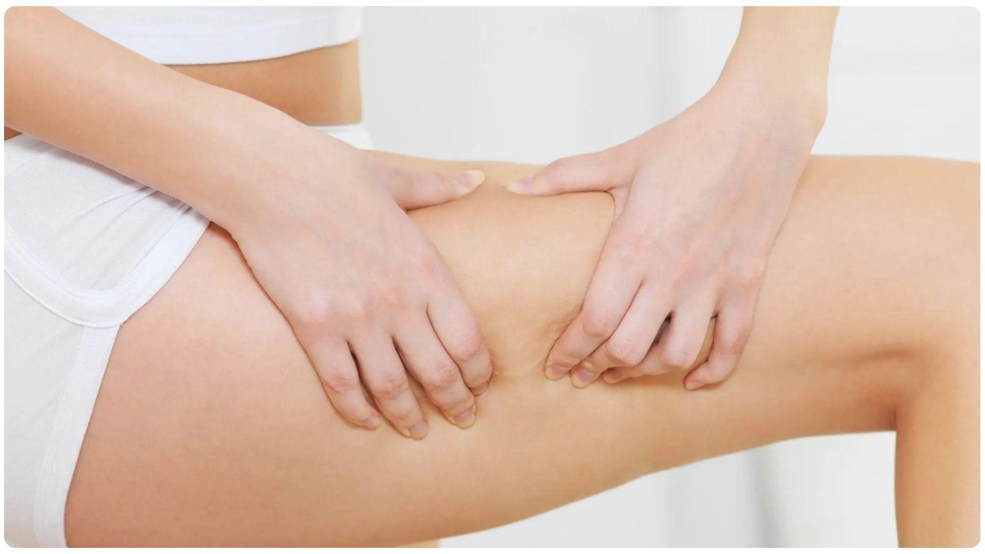 Tập gym với cường độ cao cũng là nguyên nhân khiến da đùi bị rạn