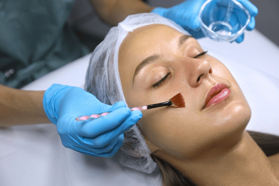 Tối thiểu 4 giờ sau khi peel da, bạn mới được rửa mặt để tránh khiến da bị tổn thương