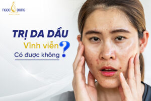 trị da dầu vĩnh viễn