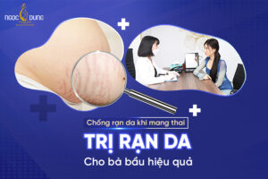 trị rạn da cho bà bầu