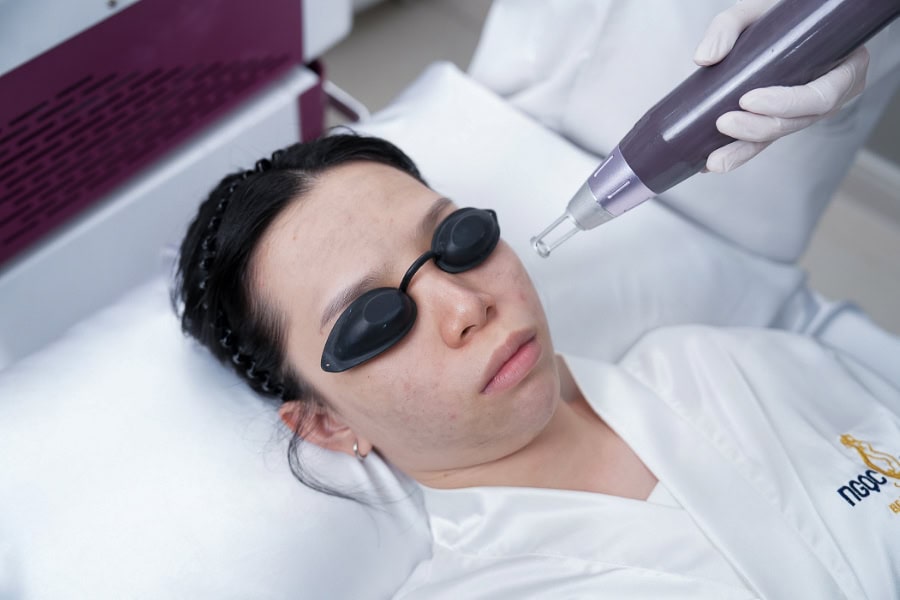 Điều trị mụn chuyên sâu, tránh mụn tái phát bằng công nghệ cao tại Ngọc Dung beauty