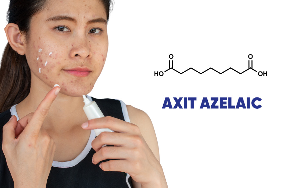 Cách làm giảm thâm mụn với hoạt chất Axit Azelaic