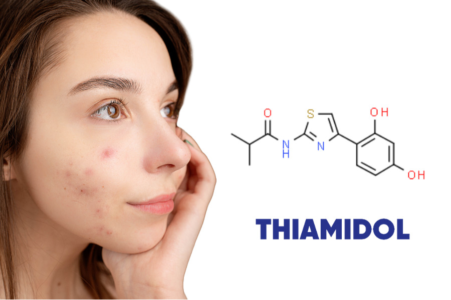 Thiamidol là thành phần hoạt tính có tác động trực tiếp đến nguyên nhân gốc rễ của vấn đề tăng sắc tố