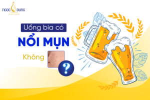 Uống bia có nổi mụn không? Nặn mụn uống bia được không?