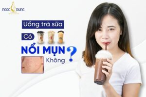 Giải đáp từ chuyên gia: Uống trà sữa có nổi mụn không?