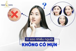 Giải đáp từ chuyên gia: Vì sao nhiều người không có mụn?