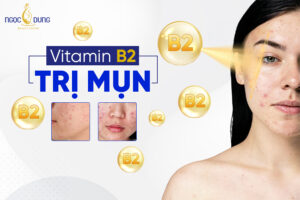 Dùng vitamin B2 trị mụn có được không?