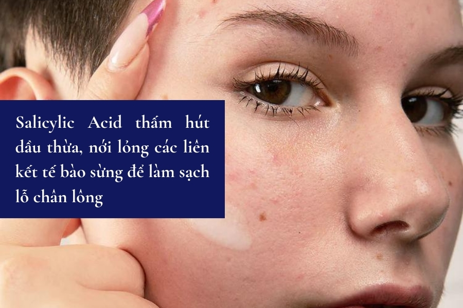 Cơ chế hoạt động của Salicylic Acid là gì?