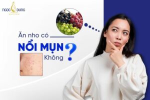 Ăn nho có nổi mụn không? Giải đáp ngay vấn đề này cùng chuyên gia