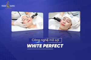 Cong nghe mo soi White Perfect