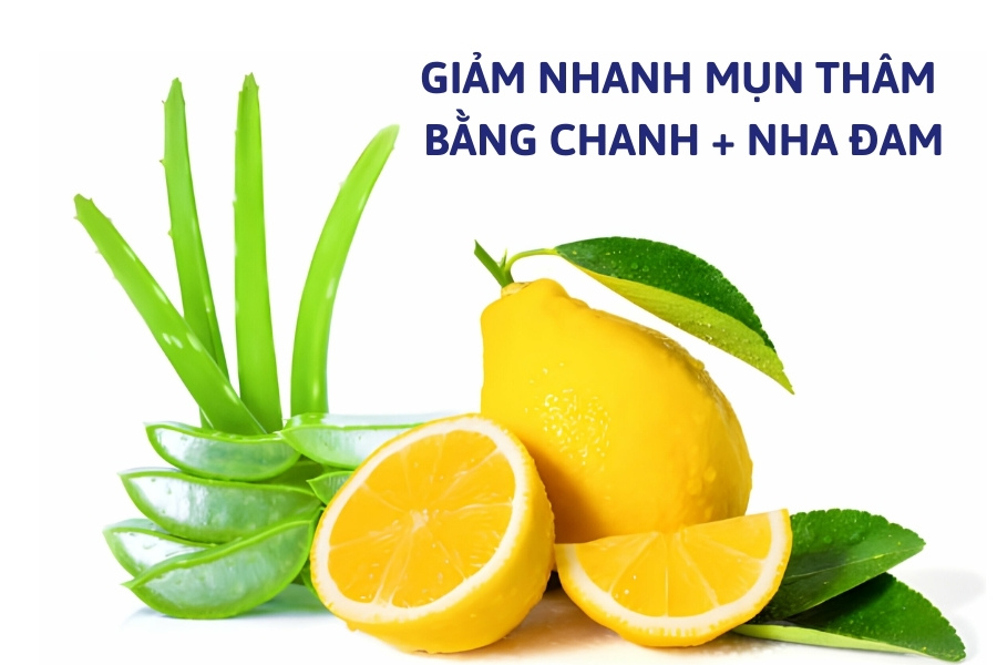 Siêu hiệu quả với cách giảm thâm mụn từ chanh và nha đam