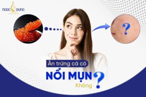 Ăn trứng cá có nổi mụn không? Giải đáp tất tần tật thắc mắc này cùng chuyên gia