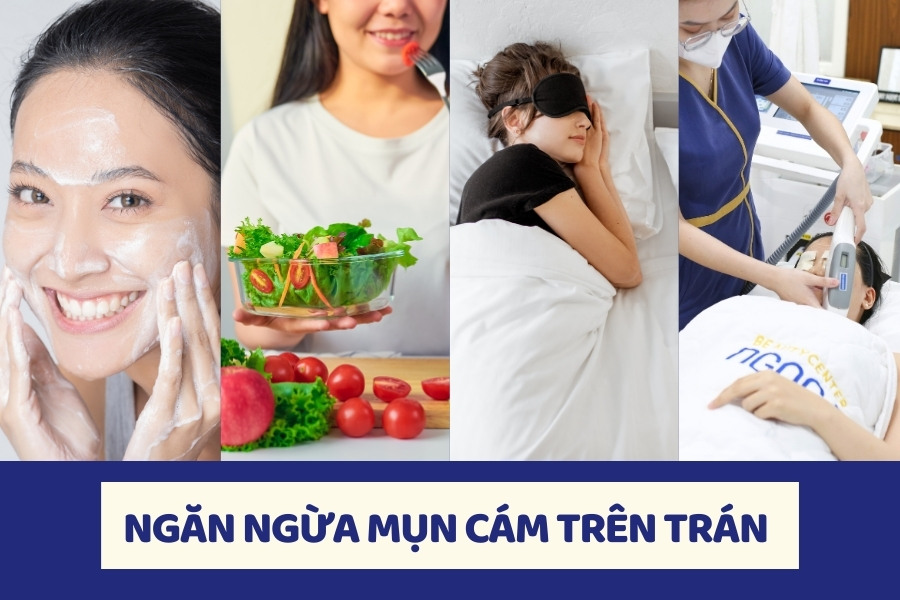 Một số lưu ý khi chăm sóc da để hạn chế mụn cám quay trở lại