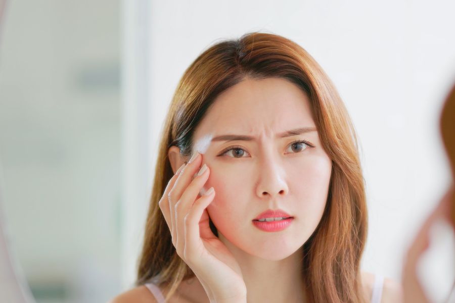 Mụn thịt thường xuất hiện khi phái đẹp bước sang tuổi 25