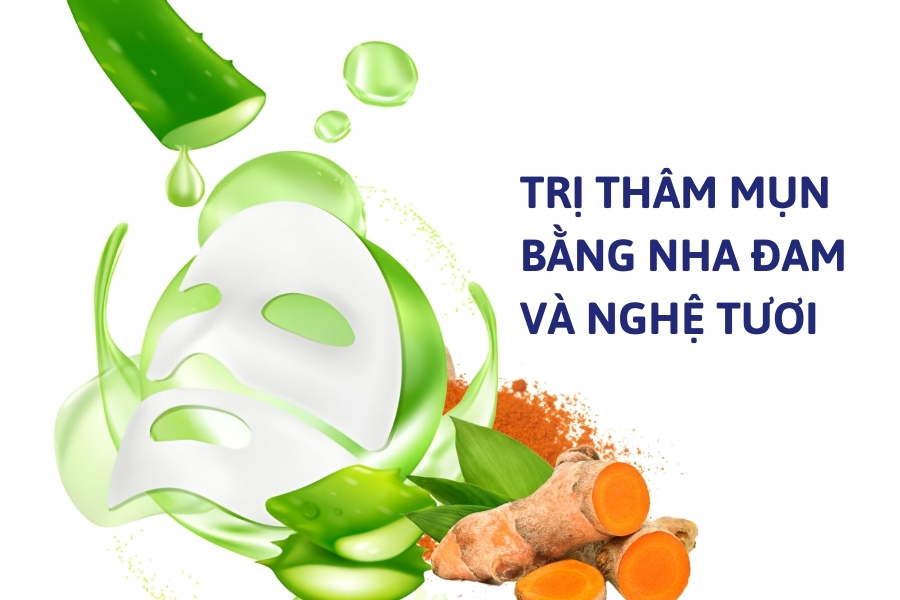 Hết mụn thâm cực dễ với nha đam và nghệ tươi